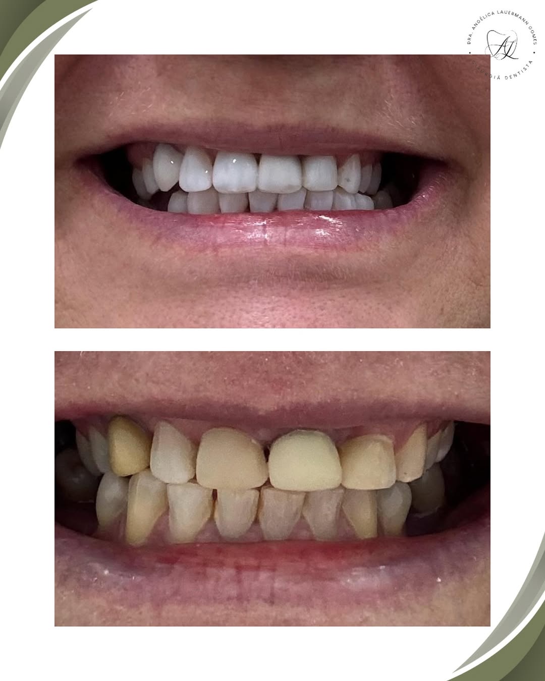 Correção de Formato e Cor (antes e depois)